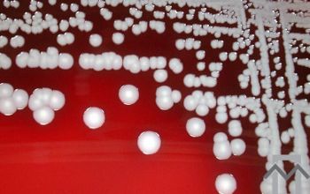 staphylococcus haemolyticus