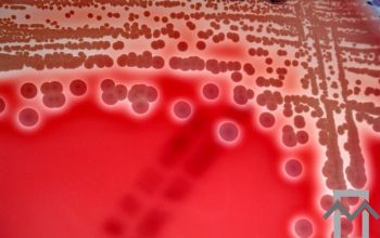 Staphylococcus haemolyticus Blood Agar 48h culture incubated with CO2