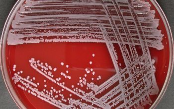 Staphylococcus haemolyticus Blood Agar 24h culture incubated with CO2