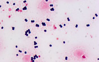 Staphylococcus hominis Gram stain