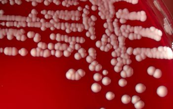 Staphylococcus intermedius Blood Agar 24h culture incubated with CO2