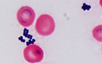 Staphylococcus lugdunensis Gram stain