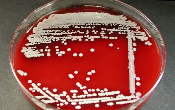 Staphylococcus lugdunensis Blood Agar 48h culture incubated with CO2