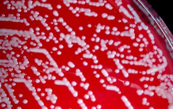 Staphylococcus saprophyticus Blood Agar 24h culture incubated with CO2
