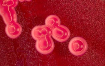 Staphylococcus saprophyticus Mac Conkey Agar without salt 48h culture incubated with O2