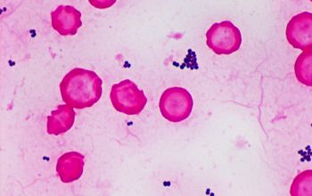 Staphylococcus schleiferi Gram stain