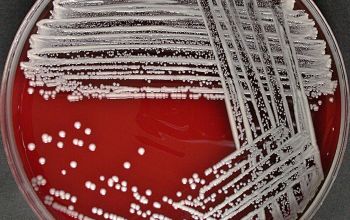 Staphylococcus schleiferi Blood Agar 48h culture incubated with CO2