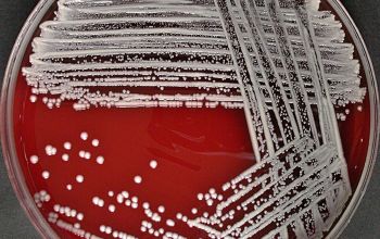 Staphylococcus schleiferi Blood Agar 48h culture incubated with CO2