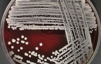 Staphylococcus schleiferi Blood Agar 48h culture incubated with CO2