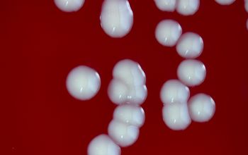 Staphylococcus schleiferi Blood Agar 48h culture incubated with CO2