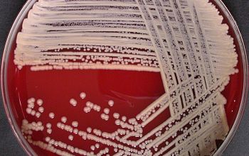 Staphylococcus sciuri Blood Agar 48h culture incubated with CO2