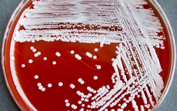 Staphylococcus simulans Blood Agar 24h culture incubated with CO2