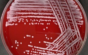 Staphylococcus xylosus Blood Agar 24h culture incubated with CO2