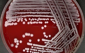 Staphylococcus xylosus Blood Agar 48h culture incubated with CO2