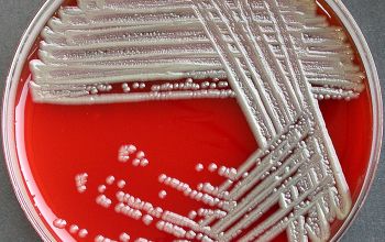 Stenotrophomonas maltophilia Blood Agar 24h culture incubated with CO2