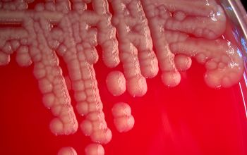 Stenotrophomonas maltophilia Blood Agar 24h culture incubated with CO2