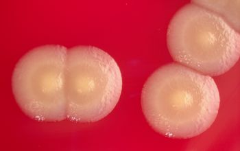 Stenotrophomonas maltophilia Blood Agar 48h culture incubated with O2