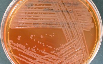 Stenotrophomonas maltophilia Mac Conkey Agar without salt 24h culture incubated with O2