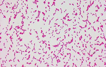 Stenotrophomonas maltophilia Gram stain