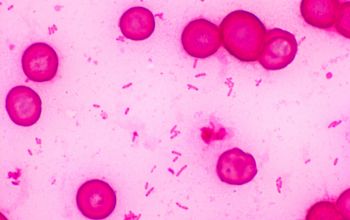 Stenotrophomonas maltophilia Gram stain