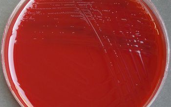 Streptobacillus moniliformis Blood Agar 48h culture incubated with CO2