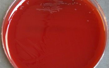 Streptobacillus moniliformis  culture incubated with CO2