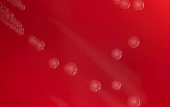 Streptobacillus moniliformis  culture incubated with CO2