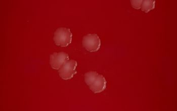 Streptobacillus moniliformis  culture incubated with CO2