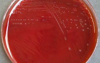 Streptobacillus moniliformis  culture incubated with CO2