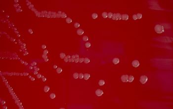 Streptobacillus moniliformis  culture incubated with CO2