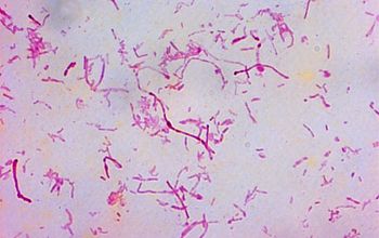 Streptobacillus moniliformis Gram stain