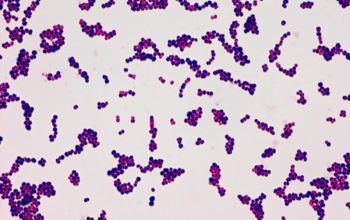 Streptococcus acidominimus Gram stain