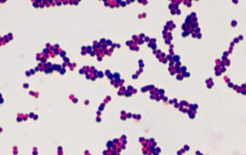 Streptococcus acidominimus Gram stain