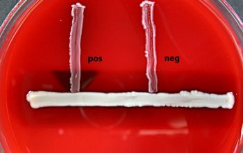 Streptococcus agalactiae  culture 