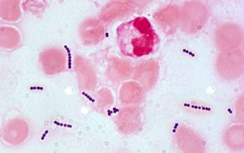 Streptococcus agalactiae Gram stain