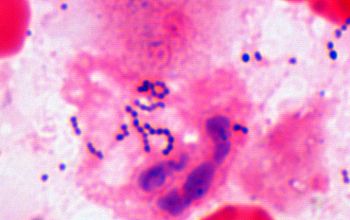 Streptococcus anginosus Gram stain