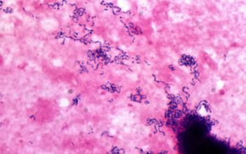 Streptococcus constellatus Gram stain