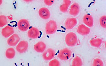 Streptococcus gallolyticus Gram stain