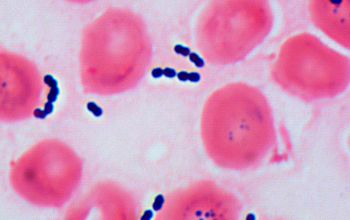 Streptococcus gallolyticus Gram stain