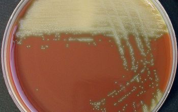 Streptococcus gordonii Chocolate Agar 24h culture incubated with CO2