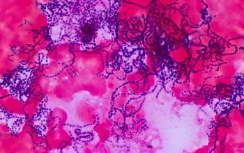 Streptococcus gordonii Gram stain