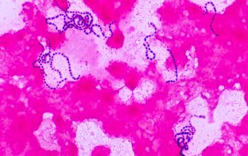 Streptococcus gordonii Gram stain