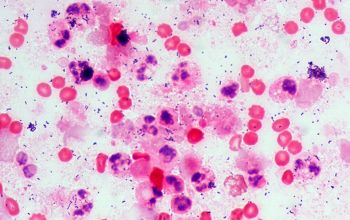 Streptococcus intermedius Gram stain