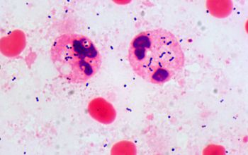 Streptococcus intermedius Gram stain