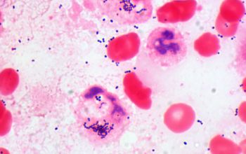 Streptococcus intermedius Gram stain