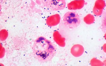 Streptococcus intermedius Gram stain