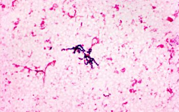 Streptococcus intermedius Gram stain