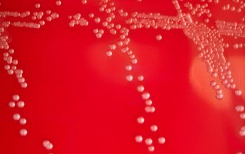 Streptococcus intermedius Blood Agar 24h culture incubated with CO2