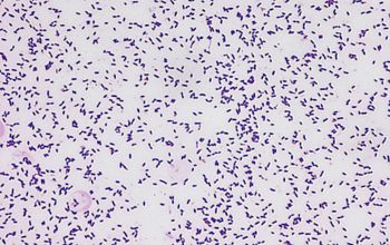 Streptococcus mutans Gram stain