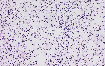 Streptococcus mutans Gram stain